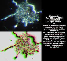 Biofilms The Culprit In Chronic Lyme Tick Talk