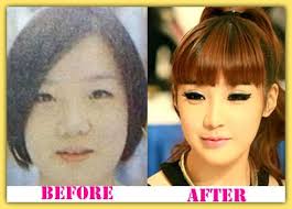 She is reported had too much different things in her appearance and it becomes an attention of public. Park Bom Plastic Surgery Before And After Parkbomplasticsurgery Parkbom Celebsplasticsurgery Plastic Surgery Celebrity Plastic Surgery Surgery