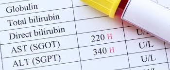 Was bedeutet diese (offenbar österreichische) abkürzung? Blutwert Alt Gpt Normalwerte Erhohung Diagnose