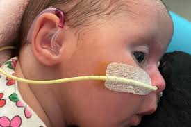 Elle's immune system is so severely compromised she has to live in a bubble  with her 'bubble mummy'