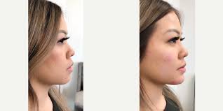 Chase Lay MD and Associates