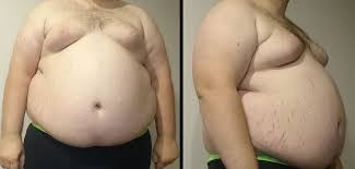 Other reasons your stomach may feel bigger is if you are having any problems in your digestive tract (2). Abdominal Obesity Wikipedia