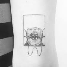 Black And White Braces Pin By Peter Laeviv On Ink In 2020 Dental Braces Teeth Braces Dental