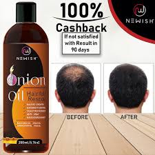 How many cigarettes do you smoke a day? Smoking And Hair Loss Quora Does Smoking Cause Hair Loss Quora Nicotine Caffeine Acetone Aluminum Ammonia Amonia Arsenic Benzene Butane