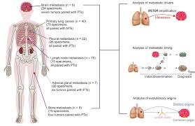 These include your blood pressure, heart rate and metab. Timing And Origins Of Local And Distant Metastases In Lung Cancer Journal Of Thoracic Oncology