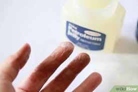 This could even happen if you are taking precautions. 6 Ways To Remove Hair Dye From Skin Wikihow