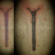 My Zipper Over My Open Heart Surgery Scar Done By Brandon At Electric Steel North Wilkesboro Nc Zipper Tattoo Tattoos Scar Tattoo