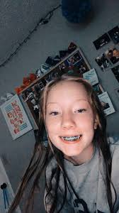 Just Got Colors On My Braces Light Blue Braces Braces Colors Dark Blue Braces
