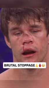 Nahom Wedi and Corey McLaughlin go to the scorecards after an absolute  battle! Cory McLaughlin gets the nod via unanimous decision! #PFLBelfast