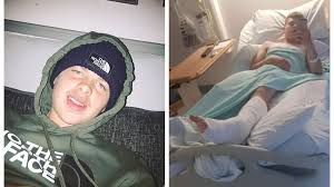 He was lying in the road covered in blood'