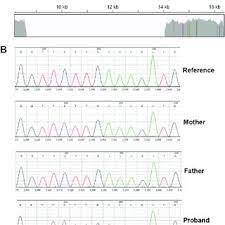 Mitochondrial Disease Proband With Complex Disease Manifestations Was Download Scientific Diagram