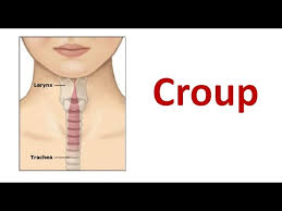 Image result for Croup