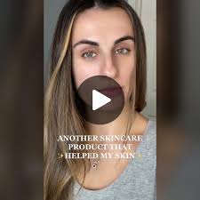 Effaclar Duo Acne Treatment Review