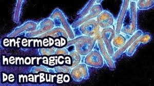 Jun 04, 2019 · virus de lassa y de hanta: Fiebre Hemorragica De Marburgo Youtube