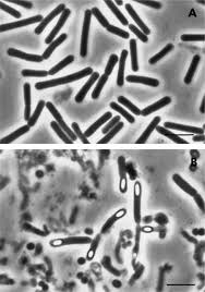 The bacteria that cause botulism produce botulinum toxin, a neurotoxin that binds to the tiny space between a nerve and a muscle, preventing the nerve from sending a message to the corresponding. Clostridium Botulinum An Overview Sciencedirect Topics