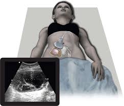 Obstetric Ultrasound | Radiology Key