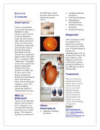 Rare genetic disorder with lens opacification. Norrie Disease