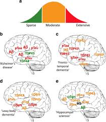 There are many different causes of dementia, and many different types. Late Onset Dementia A Mosaic Of Prototypical Pathologies Modifiable By Diet And Lifestyle Npj Aging And Mechanisms Of Disease