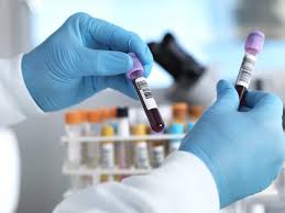 Also, used during and post treatment in case of certain cancers. A Ca 125 Blood Test Can Find Cancer And Increase Survival Rates For Women Woman Home