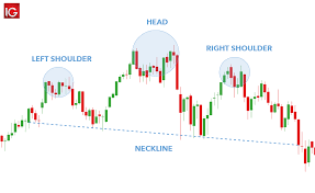 The Head And Shoulders Pattern A Traders Guide