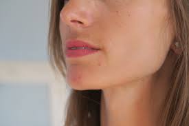 Si vous avez des boutons sous la peau qui vous font mal, voici quelques petites astuces naturelles pour les éliminer efficacement ! Acne Et Microkystes La Solution Naturelle Qui A Sauve Ma Peau