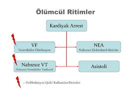 Zamanında gerekli müdahalenin yapılmaması halinde ventriküler fibrilasyon denilen ve. Dr F Mutlu Kukul Guven Acil Tip Ad Sivas Ppt Indir