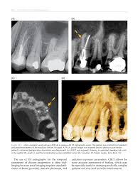 Maybe you would like to learn more about one of these? Cone Beam Computed Tomography Flip Book Pages 501 550 Pubhtml5