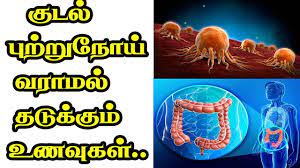 Doctors diagnose stomach cancer with a physical exam. à®µà®¯ à®± à®± à®ª à®± à®± à®¨ à®¯ à®µà®° à®µà®¤à®± à®• à®© à®…à®± à®• à®± à®•à®³ à®‡à®µ à®•à®³ à®¤ à®© Stomach Cancer Symptoms Causes In Tamil Youtube