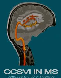 Multiple sclerosis (ms) is a chronic condition involving your central nervous system (cns). Venose Multiple Sklerose Cvi Svi Ccsvi Home Facebook