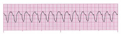 Test answers download pdf american heart association acls post test answers pdf books this is the book you are looking for, from the many there is a lot of books, user manual, or guidebook that related to american heart association acls post test answers pdf, such as : Acls Pretest Questions And Answers 2020 Full Practice Test