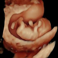 :) heute berichte ich euch von den nächsten beiden wochen meiner zweiten schwangerschaft. 3d 4d Ultraschall Und Ultraschallbilder Ihres Babys Woman Health Frauenarzt Gynakologie 1010 Wien