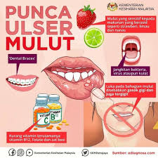 Rekomendasi cara memutihkan kulit bayi dengan pemilihan sabun adalah dengan memilih sabun dengan ph antara 4,5 hingga 5. Ismi Maizura Petua Hilangkan Ulser Dalam Mulut