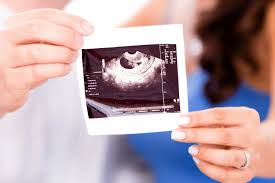 Bi Test Ultrascreening Come Si Fa Rischi E Informazioni Utili