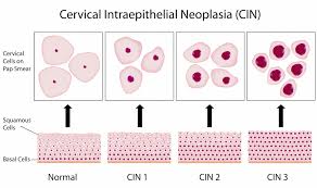 Additional health conditions, including infections, inflammation, and other types of. Cervical Cancer Oncgnostics Gmbh