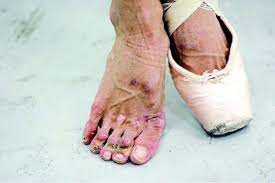 Check out amazing ballerinafeet artwork on deviantart. Professional Ballerina S Feet Wtf
