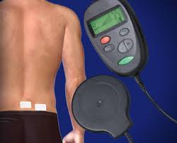 Spinal Cord Stimulator Trial Interventional Pain Spine Centers