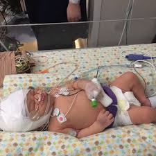 Fundraiser by Edd Davies : Leonardo Terrazas Medical Expenses