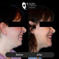 Atlanta Oral & Maxillofacial Surgery, P.C.