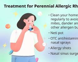 Image of Allergic rhinitis symptoms