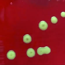 Image result for CSF Culture