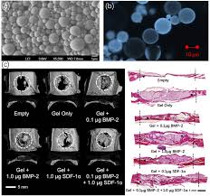 About malaysian ringgit (myr) the malaysian ringgit (sign: Hyaluronic Acid As A Bioactive Component For Bone Tissue Regeneration Fabrication Modification Properties And Biological Functions