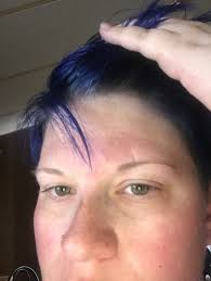 Then rub the mixture over. What Is The Quickest Way To Remove Dye From My Scalp Quora