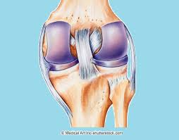 Bei einem innenmeniskusriss kommt es dementsprechend neben schmerzen zu einer funktionseinschränkung der kniebewegung. Meniskusriss Im Knie Schmerzen Symptome Operation Anriss