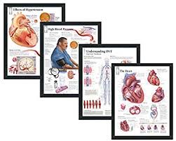 Set Of 4 Framed Medical Posters Effects Of Hypertension High