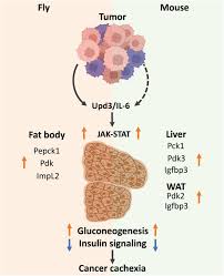Image result for Cachexia in Cancer