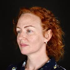 Another one of our lovely patients has...