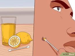 Utilize a hot shrink towards the region. 3 Ways To Get Rid Of Ingrown Hair Scars Wikihow