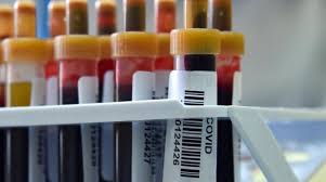 عدم وضع السائل المنوي العميق بما فيه الكفاية بحيث يصل إلى عنق الرحم. Ø£Ø¯ÙˆÙŠØ© Ù…Ù†Ø¹ ØªØ¬Ù„Ø· Ø§Ù„Ø¯Ù… Ù‚Ø¯ ØªÙ†Ù‚Ø° Ø­ÙŠØ§Ø© Ù…Ø±Ø¶Ù‰ ÙƒÙˆØ±ÙˆÙ†Ø§ Ø§Ù„Ø´Ø±Ù‚ Ø§Ù„Ø£ÙˆØ³Ø·