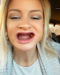 How I chew while wearing dentures 🦷😬