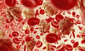 Maybe you would like to learn more about one of these? A Novel Target Revealed For Myelodysplastic Syndrome